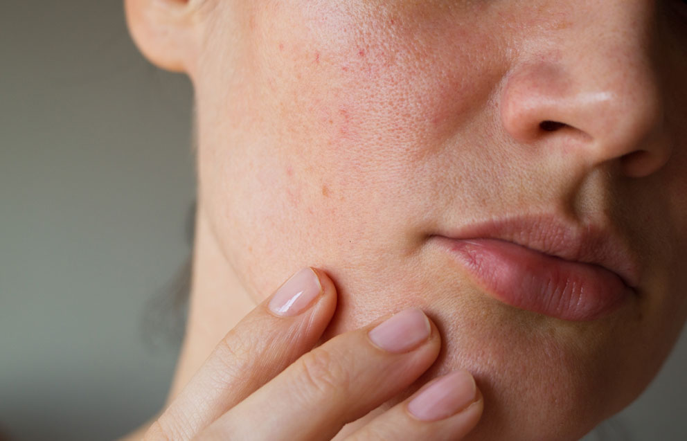 Sintomi visibili della dermatite atopica