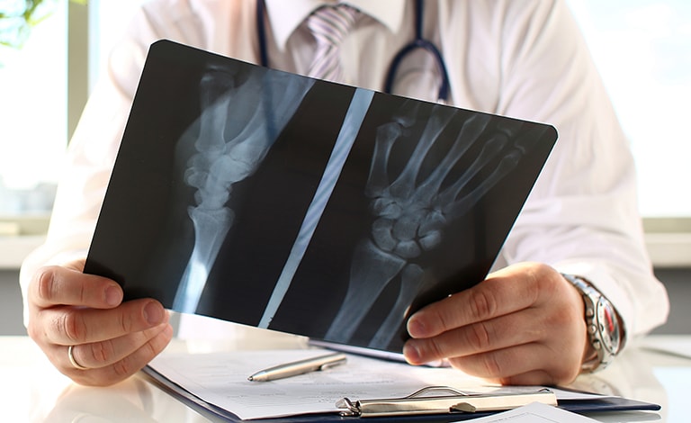 medico che osserva radiografia di mano e altra articolazione