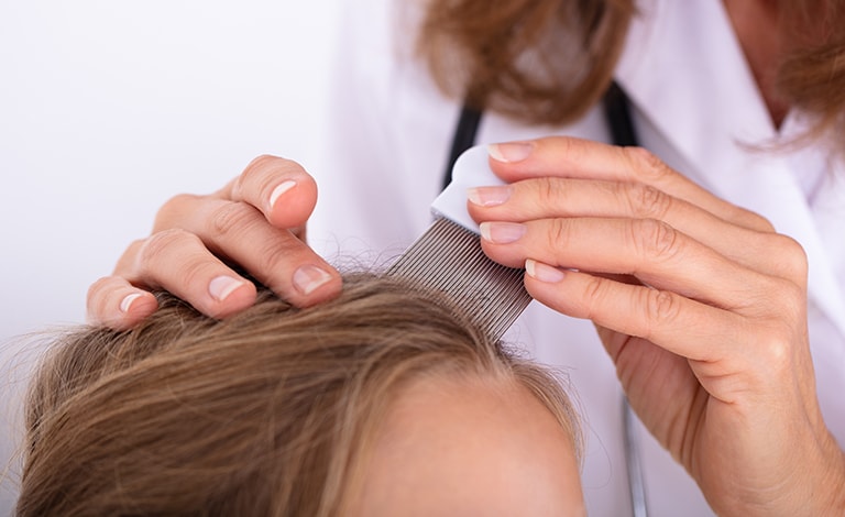 applicazione di una terapia topica per la psoriasi cuoio capelluto
